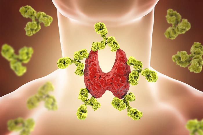 여드름, 단순 트러블이 아닌 염증성 질환입니다